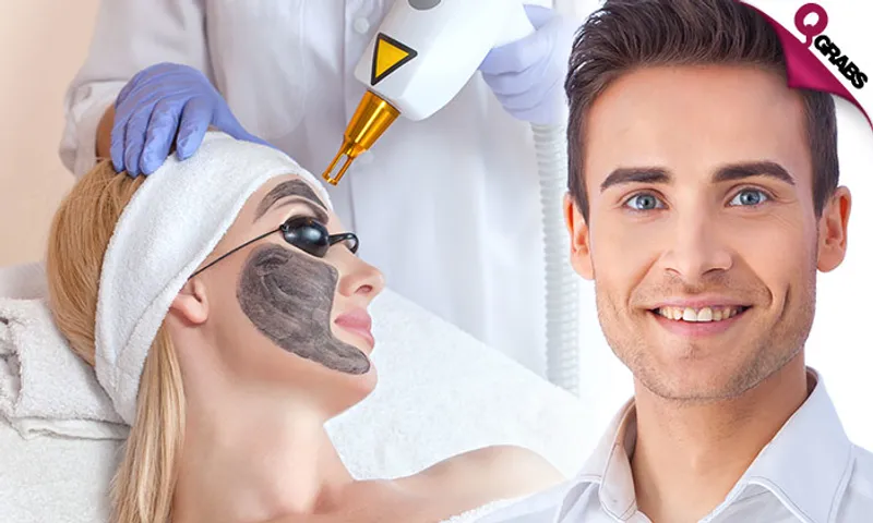 Carbon Laser Peel + Consultation for Ladies & Men!